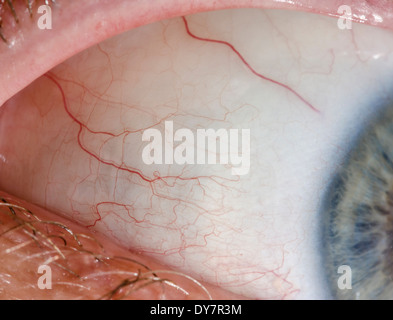 Eyeball closeup. Macro of the sclera and veins of a white mans eyeball. Stock Photo