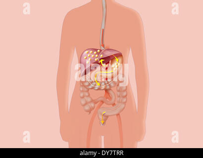 Cholesterol Stock Photo