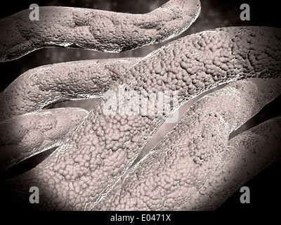 Microscopic view of corncob formation in dental plaque. Stock Photo