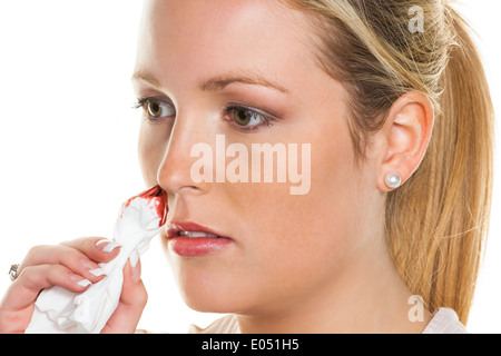 A young woman bleeds from her nose. Stops noses bleed with a handkerchief., Eine junge Frau blutet aus ihrer Nase. Stoppt Nasen Stock Photo