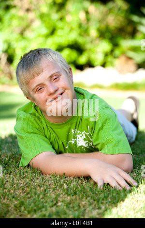 Portrait of cute handicapped boy laying on green grass. Stock Photo
