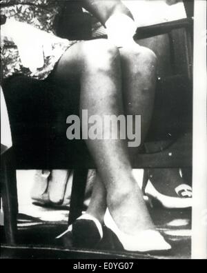 Apr. 04, 1970 - Royal Tour of Australia: Mosquitoes leave marks on Princess Anne's Legs. Photo Shows Queensland mosquitoes have Stock Photo