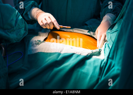 median sternotomy incision Stock Photo