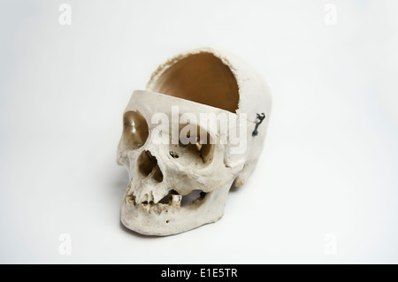 Genuine Human Skull with the front quarter removed used for Medical Studies Stock Photo