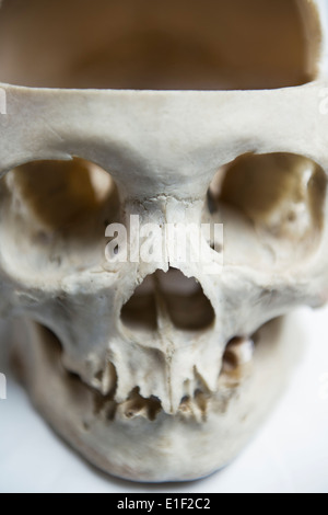 Genuine Human Skull with  front quarter removed used for Medical Studies Stock Photo