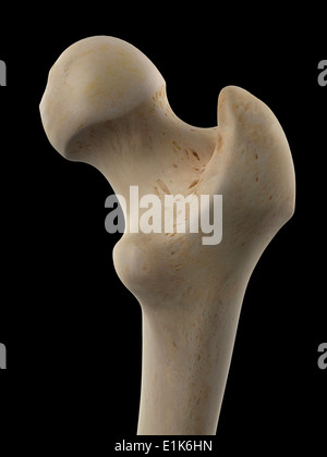 Femur bone human, close up of upper part to show the neck of femur ...