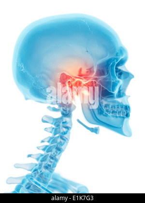 Human jaw joint computer artwork. Stock Photo