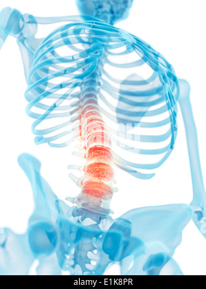 Human lumbar spine computer artwork. Stock Photo