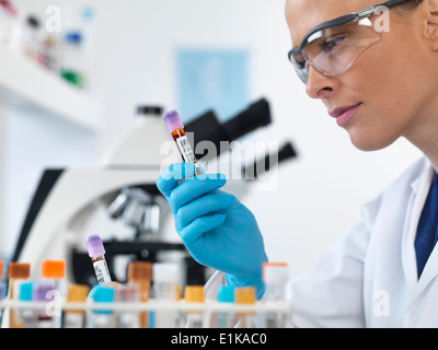 Close Up View To Test Tube with Urine and Blood Sticking Out from a Blue  Jeans Pocket Stock Photo - Image of equipment, medical: 149112006