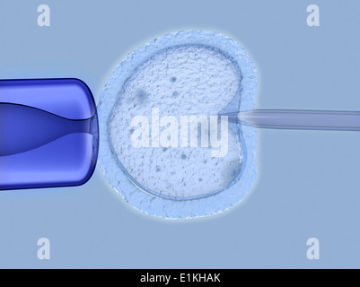 Artwork of in vitro fertilisation. Stock Photo