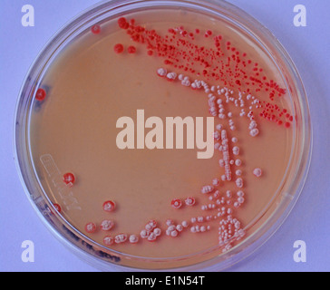 Top View of Culture plate of bacterial growth showing antibiotic ...