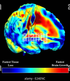 Schizophrenia Stock Photo