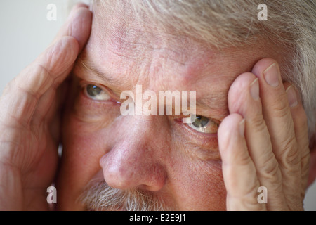 man suffering from headache in his temples Stock Photo
