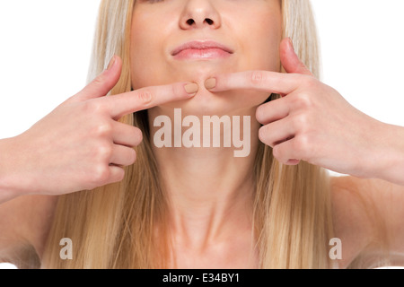 Closeup on teenager poping pimple Stock Photo