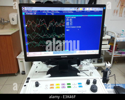 BERA Brainstem evoked response audiometry Stock Photo