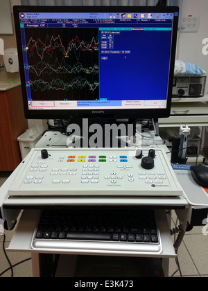 BERA Brainstem evoked response audiometry Stock Photo