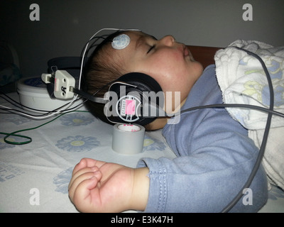 Brainstem evoked response audiometry - BERA Stock Photo