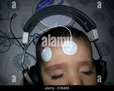 Brainstem evoked response audiometry - BERA Stock Photo