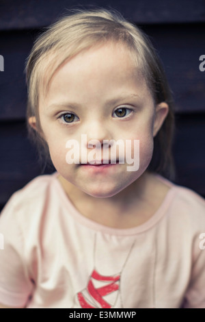 Thoughtful girl with down syndrome looking away Stock Photo