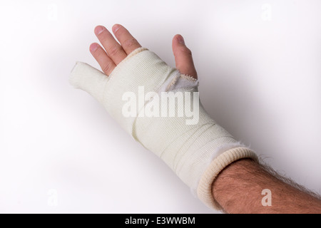 Little finger/Arm/Wrist in cast on a white background, studio isolated Stock Photo