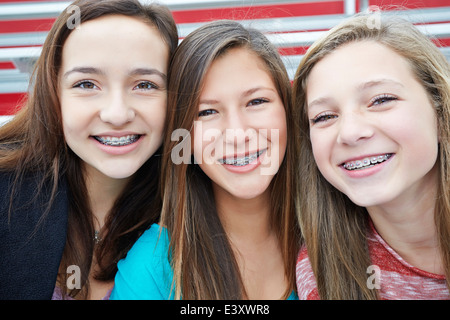 Teenage girls showing off braces together Stock Photo