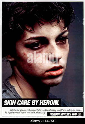 'Skin Care by Heroin.' Part of the 'Heroin Screws You Up' drug awareness campaign. 1986 poster featuring a young male addict. Stock Photo