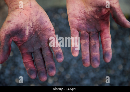 Pair of Brazilian hands stained purple from the juice of fresh acai berries juice Stock Photo