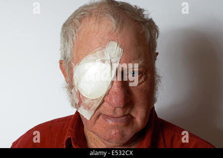 Patient recovering after cataract eye surgery Stock Photo