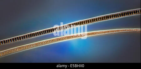 Short tailed field vole Microtus agrestis, darkfield photomicrograph Stock Photo