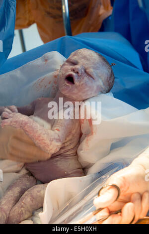 Baby boy being born by Caesarean Section in operating theatre at hospital Wales UK Stock Photo