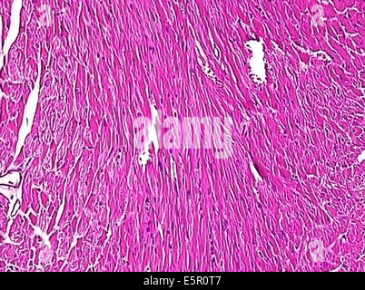 Photomicrograph of cells of striated muscle Stock Photo - Alamy