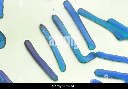 Transmission electron micrograph (TEM) of filamentous Marburg virus. Stock Photo