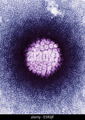 Colored transmission electron micrograph (TEM) of human papillomavirus (HPV), The HPV is involved in the development of Stock Photo