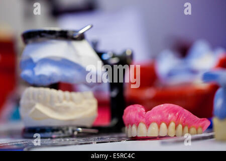 Fabrication of complete dentures. Stock Photo