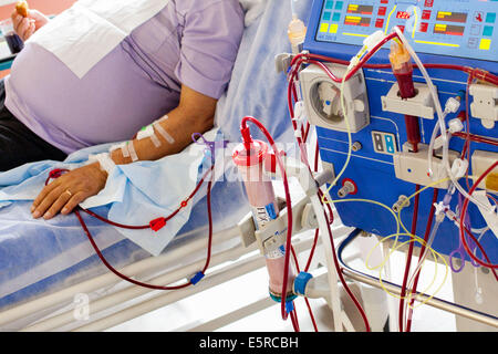 HEMODIALYSIS OF A MAN Stock Photo: 48403136 - Alamy