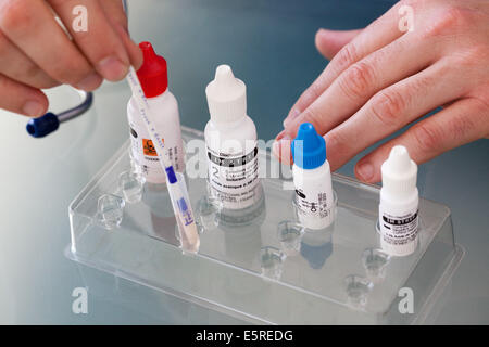 Diagnostic test to determine the viral or bacterial (streptococcus ...