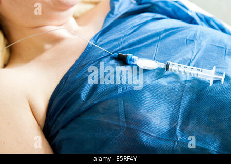 Pregnant woman receiving epidural anaesthesia before delivery, Self controlled anesthesia, Maternity department, Cochin Stock Photo