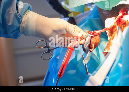 Harvesting umbilical cord stem cells. Midwife collecting blood from an umbilical cord. Obstetrics and gynaecology department, Stock Photo