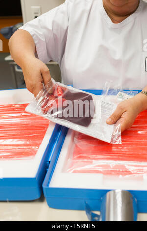 Umbilical cord blood for stem cell harvesting. Bag of placental blood. Obstetrics and gynaecology department, Limoges hospital, Stock Photo