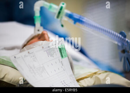 General anesthesia, patient monitoring sheet. Stock Photo