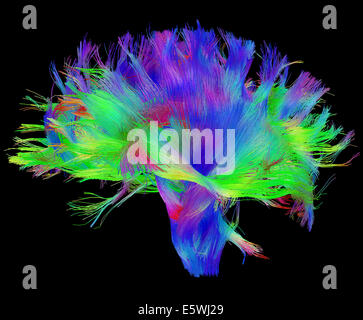 White matter fibres of the human brain Stock Photo - Alamy