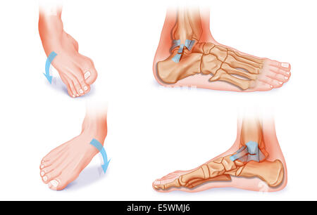 Sprained ankle, drawing Stock Photo - Alamy