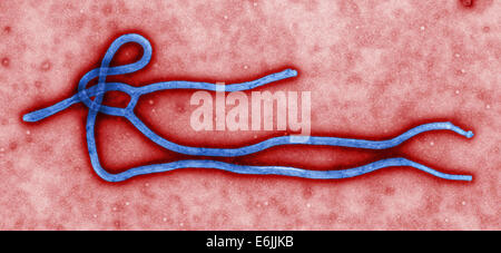 Microscopic view of the Ebola virus. This colorized transmission electron micrograph view of the ultrastructural morphology displayed by an Ebola virus virion was captured by the CDC.