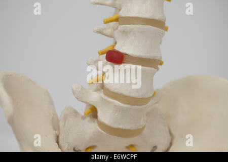 section of human spine Stock Photo