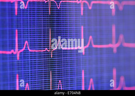 Tablet computer screen displaying an electrocardiogram Stock Photo