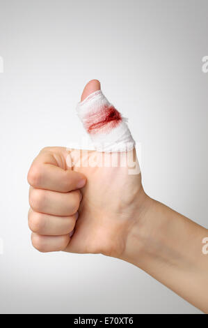 Injured finger with bloody gauze bandage Stock Photo