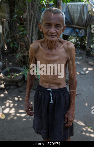 Borobudur, Java, Indonesia.  Emaciated Indonesian Man. Stock Photo