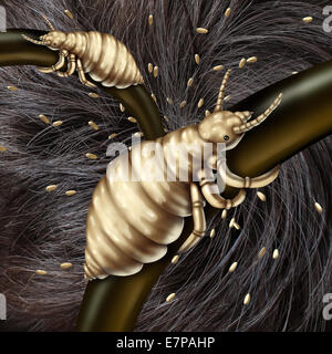 Lice in hair problem as a medical concept with a macro close up of a human head with an infestation of parasitic nits or eggs hatching from a louse insect as a symbol of infection and treatment. Stock Photo