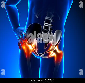 Hip Bone - Pain in Hip Bone - Hurt Hip Bone Stock Photo