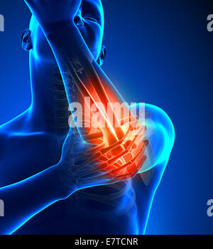 Elbow Pain Male - Front view Stock Photo